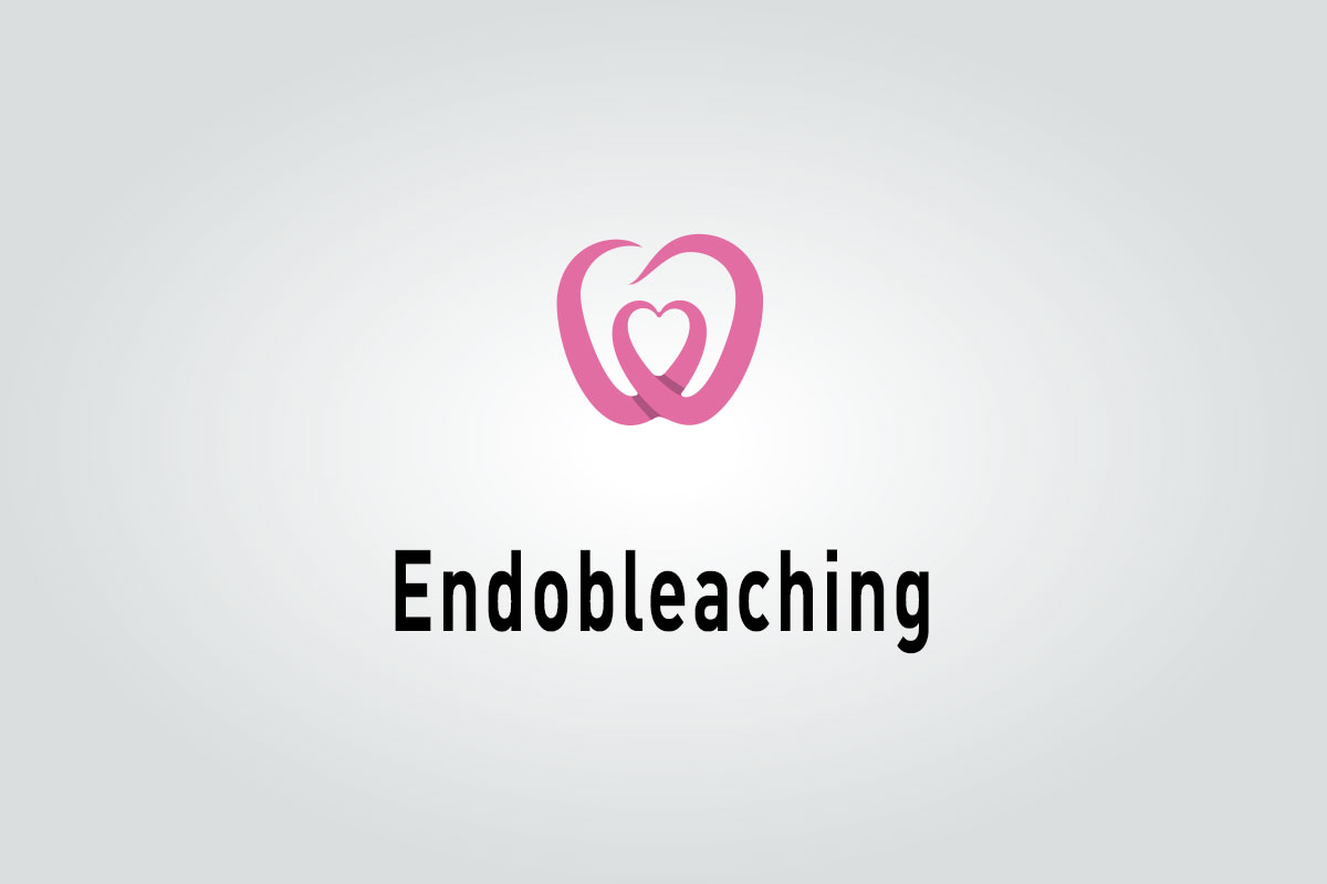Endobleaching